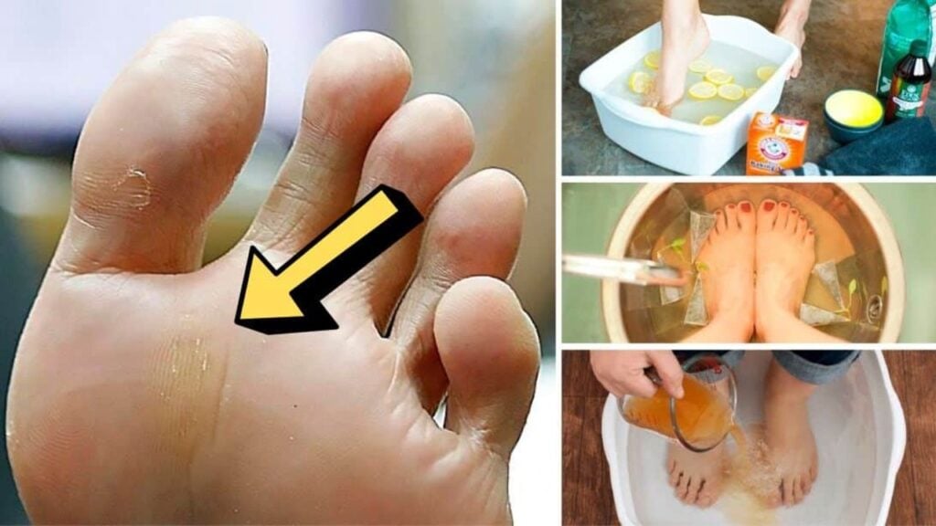 How To Get Rid Of Foot Odor For Good