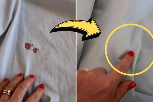 How To Remove Dried Blood Stains Quickly