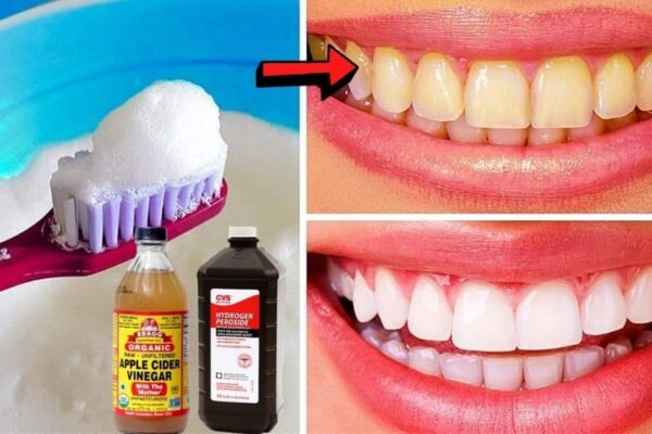 8 Ways To Naturally Whiten Your Teeth