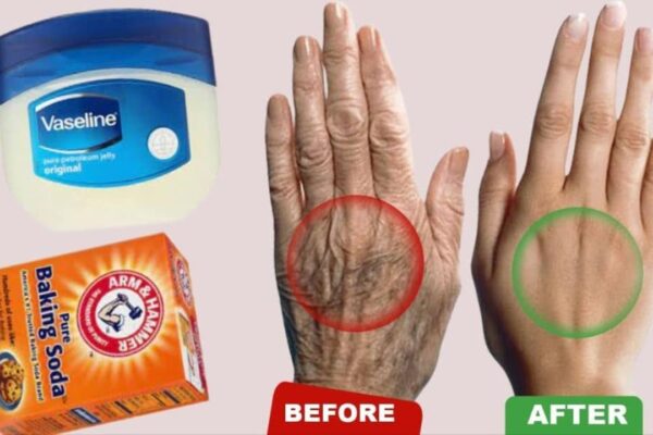 How to Get Soft Smooth and Wrinkle-Free Hands